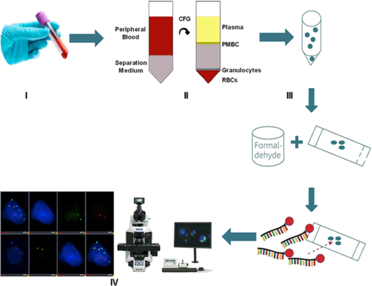Detection of circulating genetically abnormal cells in peripheral blood for early diagnosis of non-small cell lung cancer