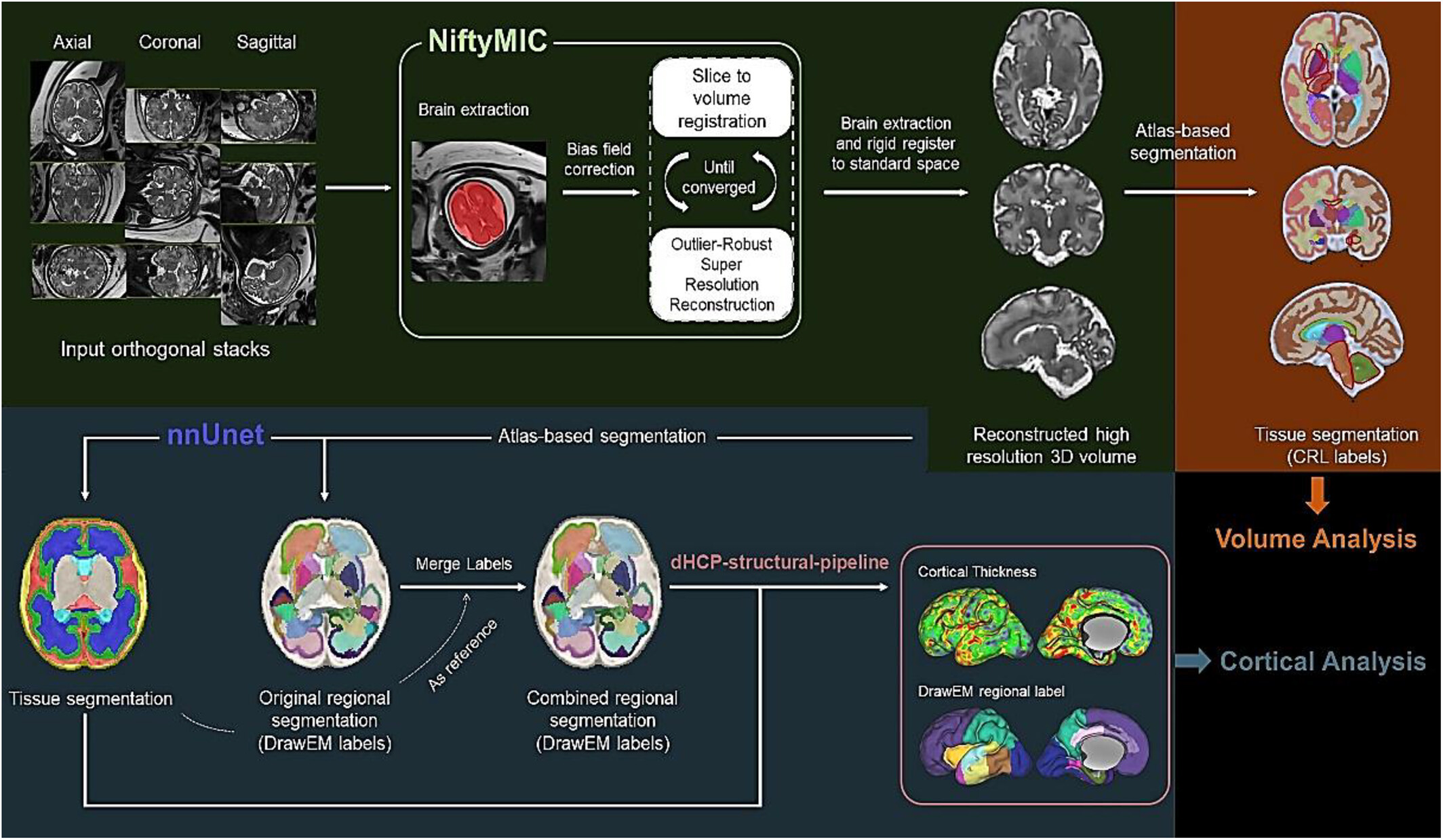 Advanced neuroimaging in the fetal brain: An update on technical advances and clinical findings