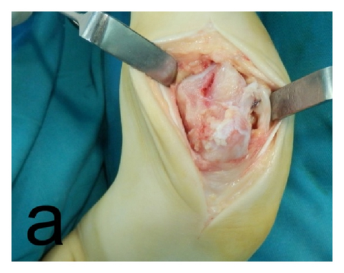 Details are in the caption following the image Details are in the caption following the image