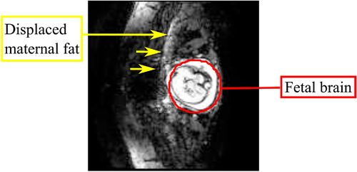 Details are in the caption following the image
