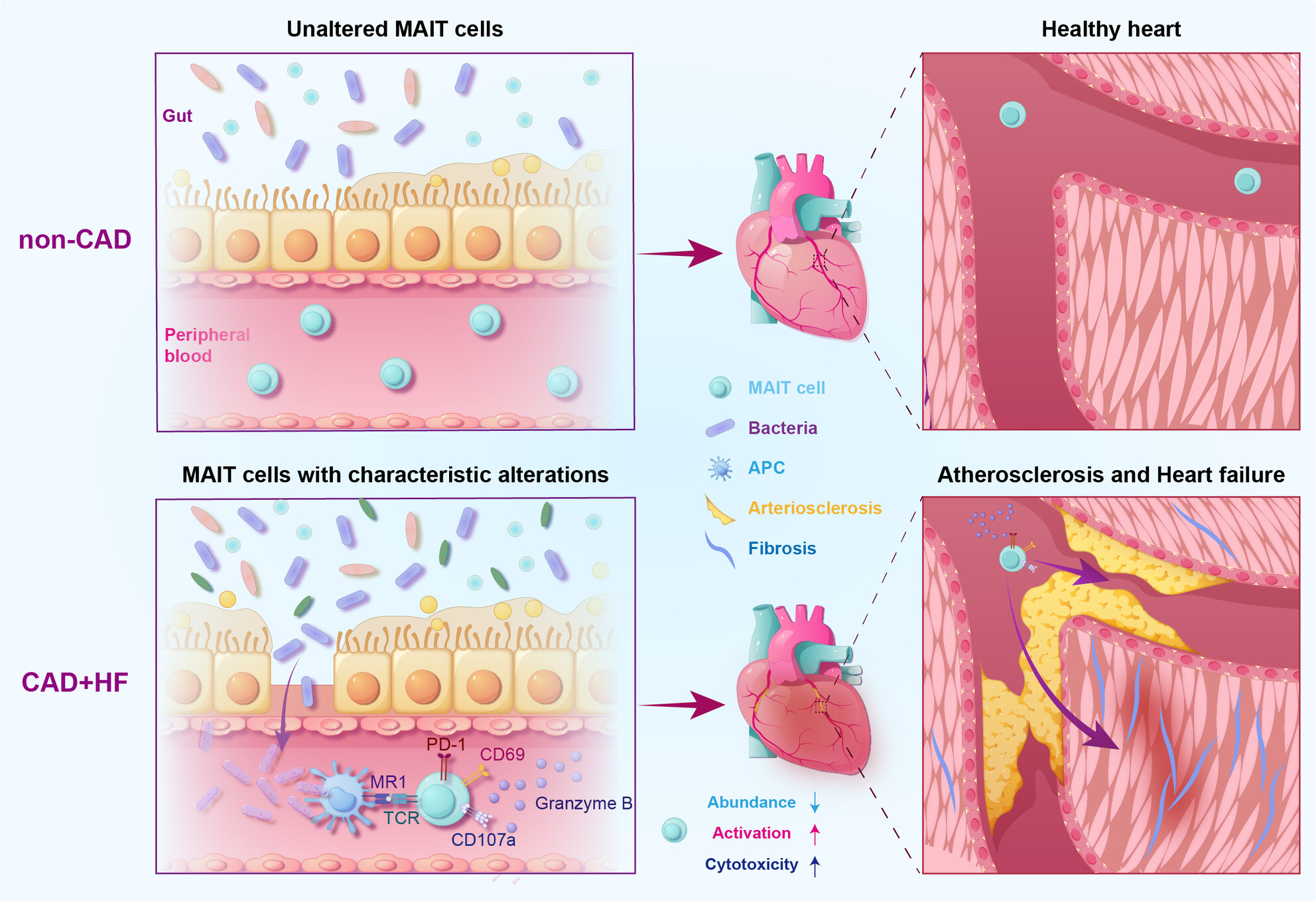 Mucosal-associated invariant T cells correlate with myocardial ischaemia and remodelling in coronary artery disease