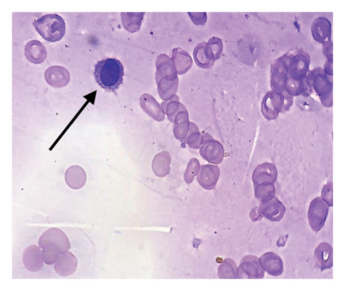 Details are in the caption following the image