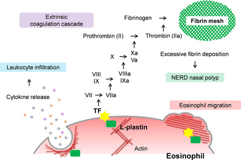 Increased expression of L-plastin in nasal polyp of patients with nonsteroidal anti-inflammatory drug-exacerbated respiratory disease