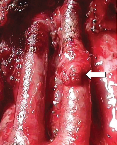 Details are in the caption following the image