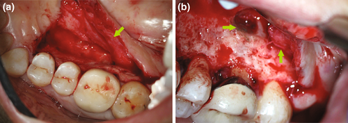 Details are in the caption following the image Details are in the caption following the image