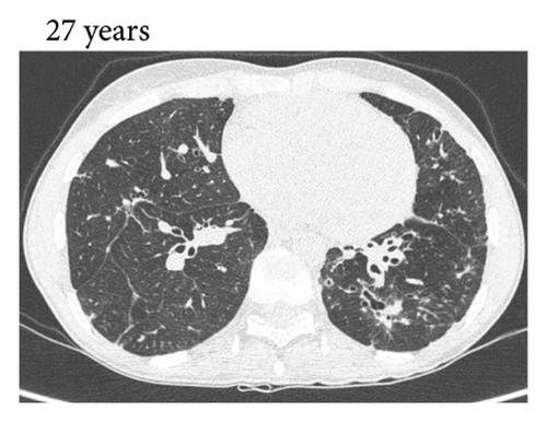 Details are in the caption following the image