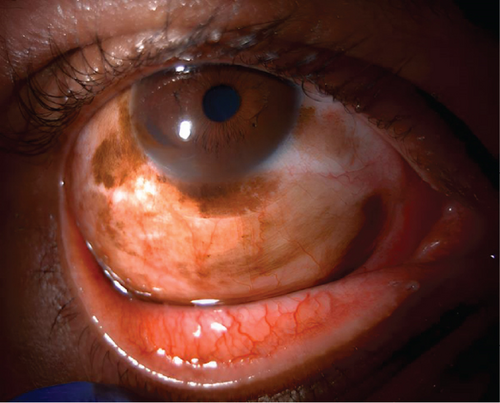 Details are in the caption following the image Details are in the caption following the image