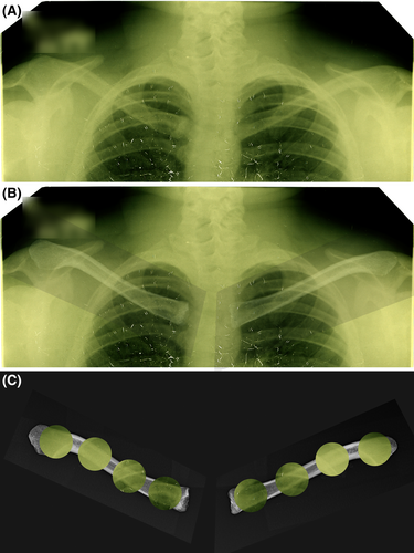 Details are in the caption following the image