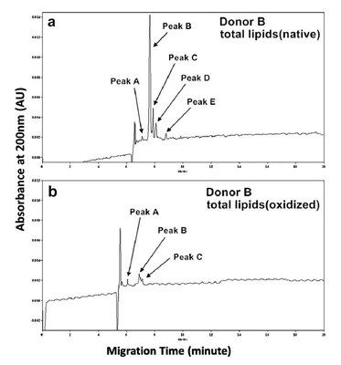 Separation of Lipids on Human Very Low-density Lipoproteins by Micellar Electrokinetic Chromatography