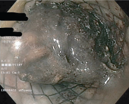 Details are in the caption following the image Details are in the caption following the image