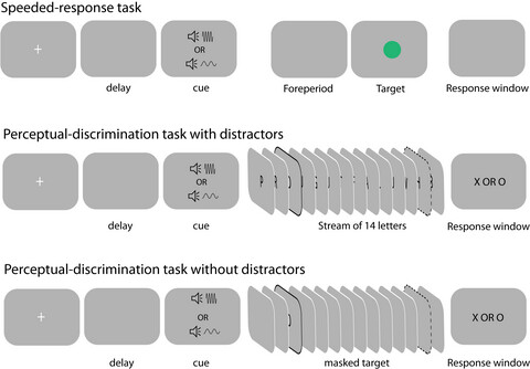 Temporal orienting in Parkinson’s disease