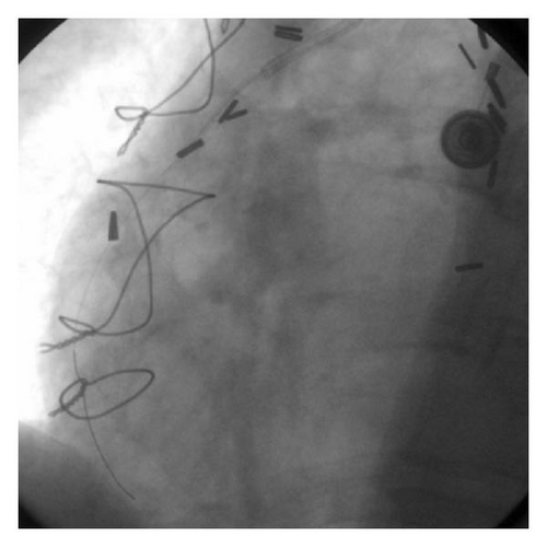 Details are in the caption following the image Details are in the caption following the image