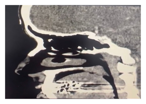 Details are in the caption following the image