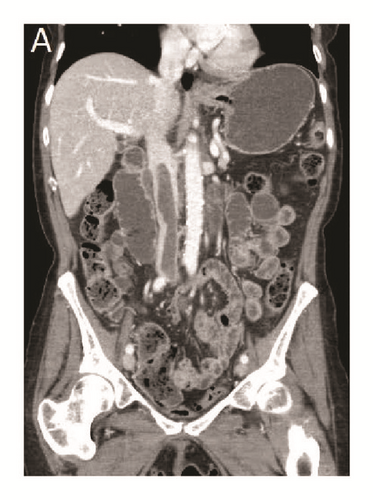 Details are in the caption following the image