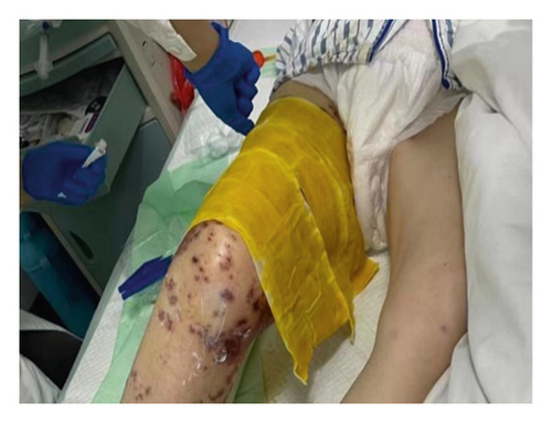 Details are in the caption following the image Details are in the caption following the image