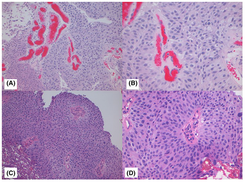 Details are in the caption following the image Details are in the caption following the image