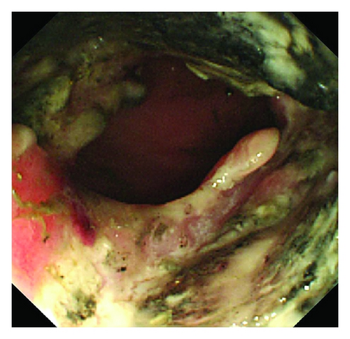 Details are in the caption following the image Details are in the caption following the image
