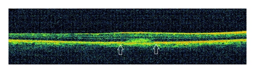 Details are in the caption following the image