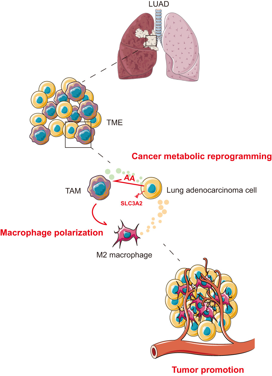 SLC3A2 promotes tumor-associated macrophage polarization through metabolic reprogramming in lung cancer