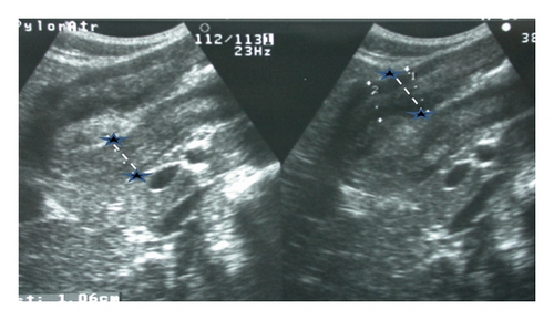 Details are in the caption following the image