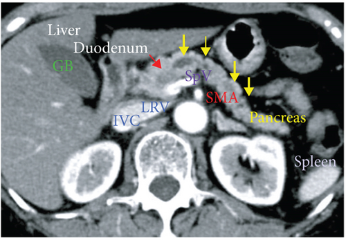 Details are in the caption following the image