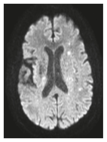 Details are in the caption following the image