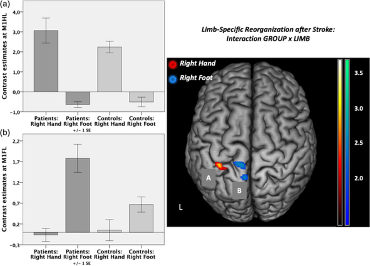Cortical reorganization after motor stroke: A pilot study on differences between the upper and lower limbs