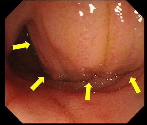 Details are in the caption following the image Details are in the caption following the image
