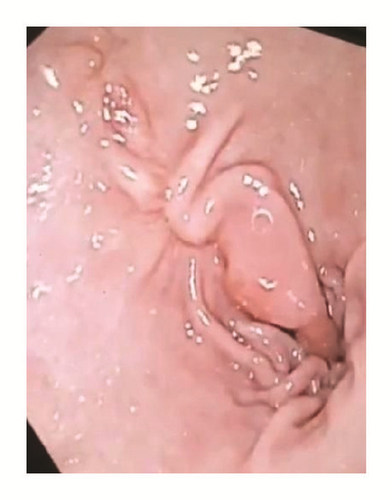 Details are in the caption following the image