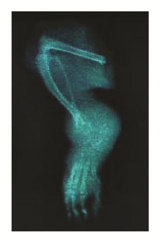 Details are in the caption following the image