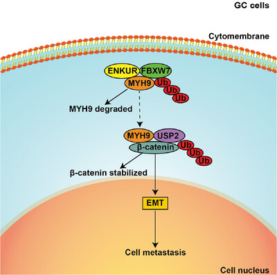 RETRACTED: ENKUR recruits FBXW7 to ubiquitinate and degrade MYH9 and further suppress MYH9-induced deubiquitination of β-catenin to block gastric cancer metastasis