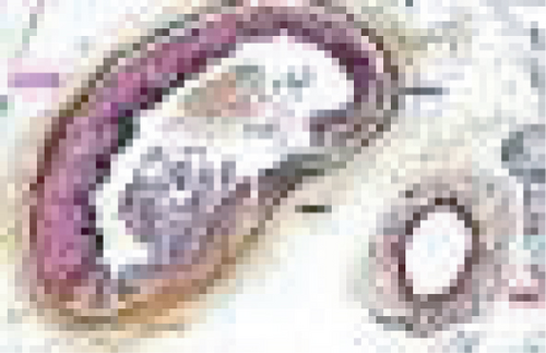 Details are in the caption following the image