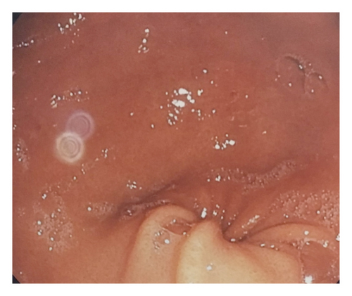Details are in the caption following the image Details are in the caption following the image