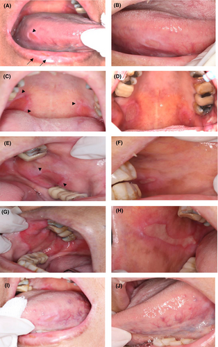 Details are in the caption following the image Details are in the caption following the image