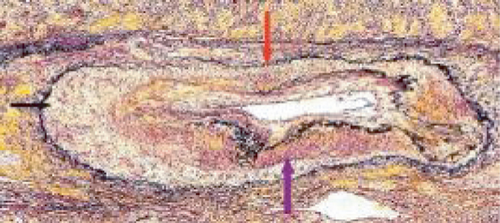 Details are in the caption following the image