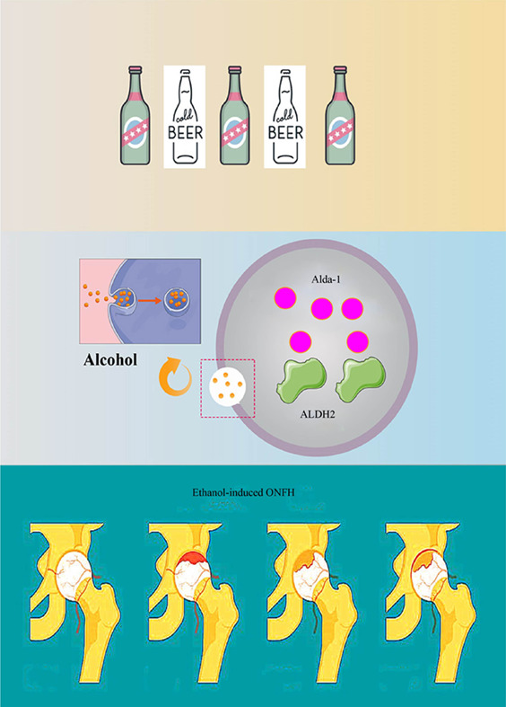 Activation of aldehyde dehydrogenase 2 protects ethanol-induced osteonecrosis of the femoral head in rat model