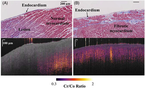 Multicontrast endomyocardial imaging by single-channel high-resolution cross-polarization optical coherence tomography