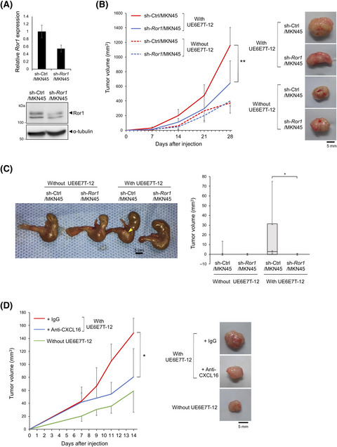 Mesenchymal stem cell-derived CXCL16 promotes progression of gastric cancer cells by STAT3-mediated expression of Ror1