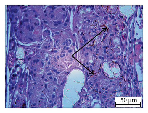 Details are in the caption following the image