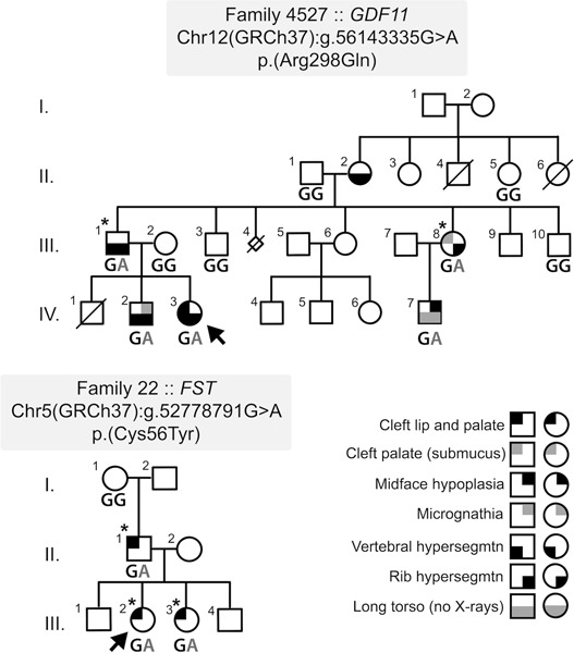Mutations in GDF11 and the extracellular antagonist, Follistatin, as a likely cause of Mendelian forms of orofacial clefting in humans