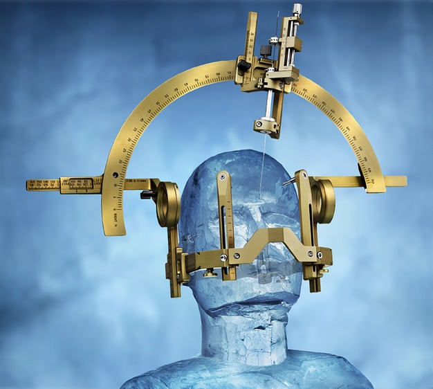 Anesthesia for deep brain stimulation in traumatic brain injury-induced hemidystonia