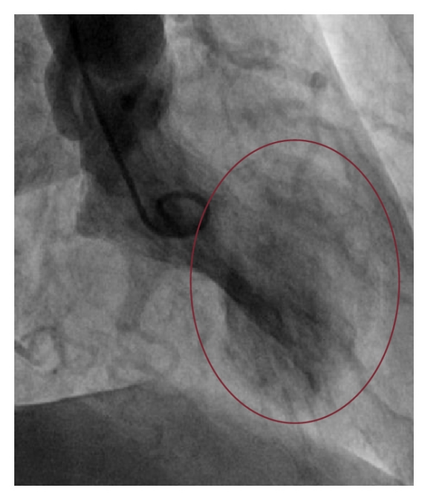 Details are in the caption following the image