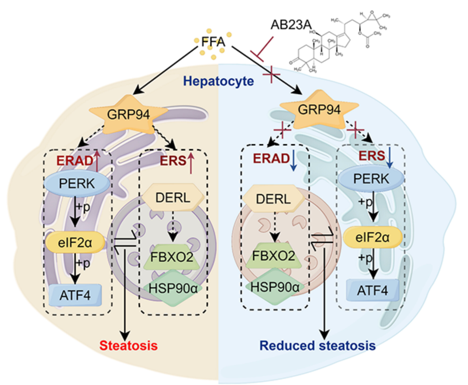 Alisol B 23-Acetate Down-Regulated GRP94 to Restore Endoplasmic Reticulum Homeostasis on Non-Alcoholic Steatohepatitis