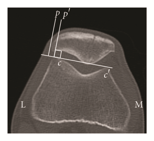 Details are in the caption following the image
