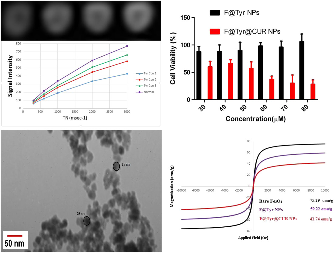 Preparation and characterization of magnetic theranostic nanoparticles for curcumin delivery and evaluation as MRI contrast agent