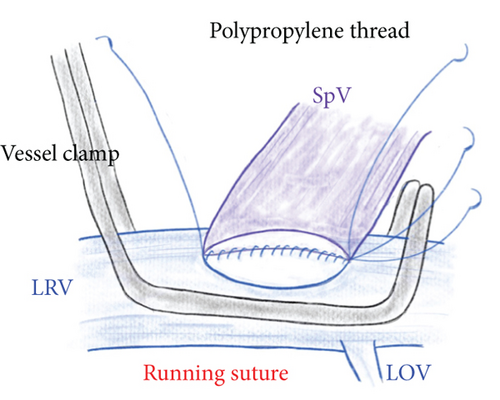Details are in the caption following the image
