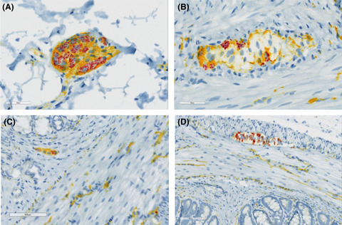 Enteric RET inhibition attenuates gastrointestinal secretion and motility via cholinergic signaling in rat colonic mucosal preparations