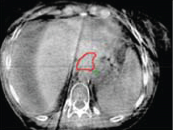 Details are in the caption following the image