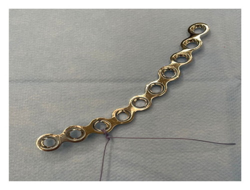 Details are in the caption following the image Details are in the caption following the image
