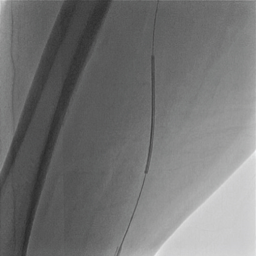 Details are in the caption following the image